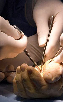 Hand & Microvascular Surgery
