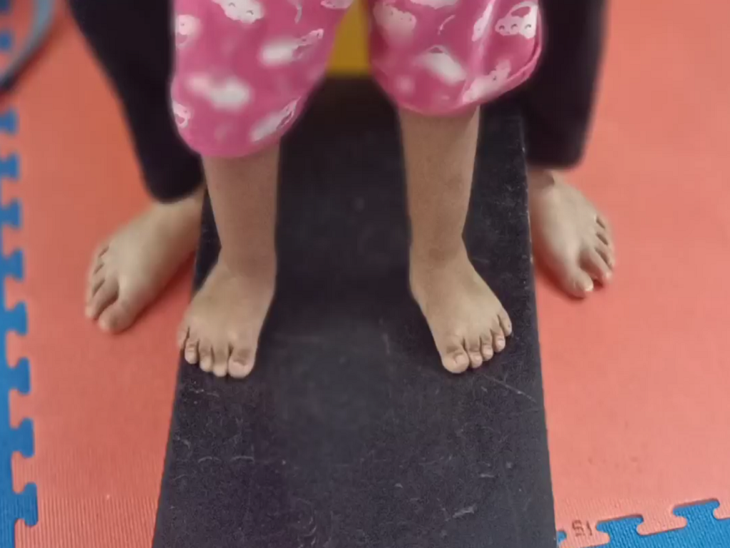 What Is A Clubfoot? What Is The Treatment?