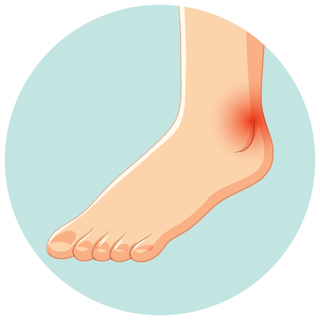 Roots of Discomfort: Understanding the Causes of Foot Pain - Sancheti ...