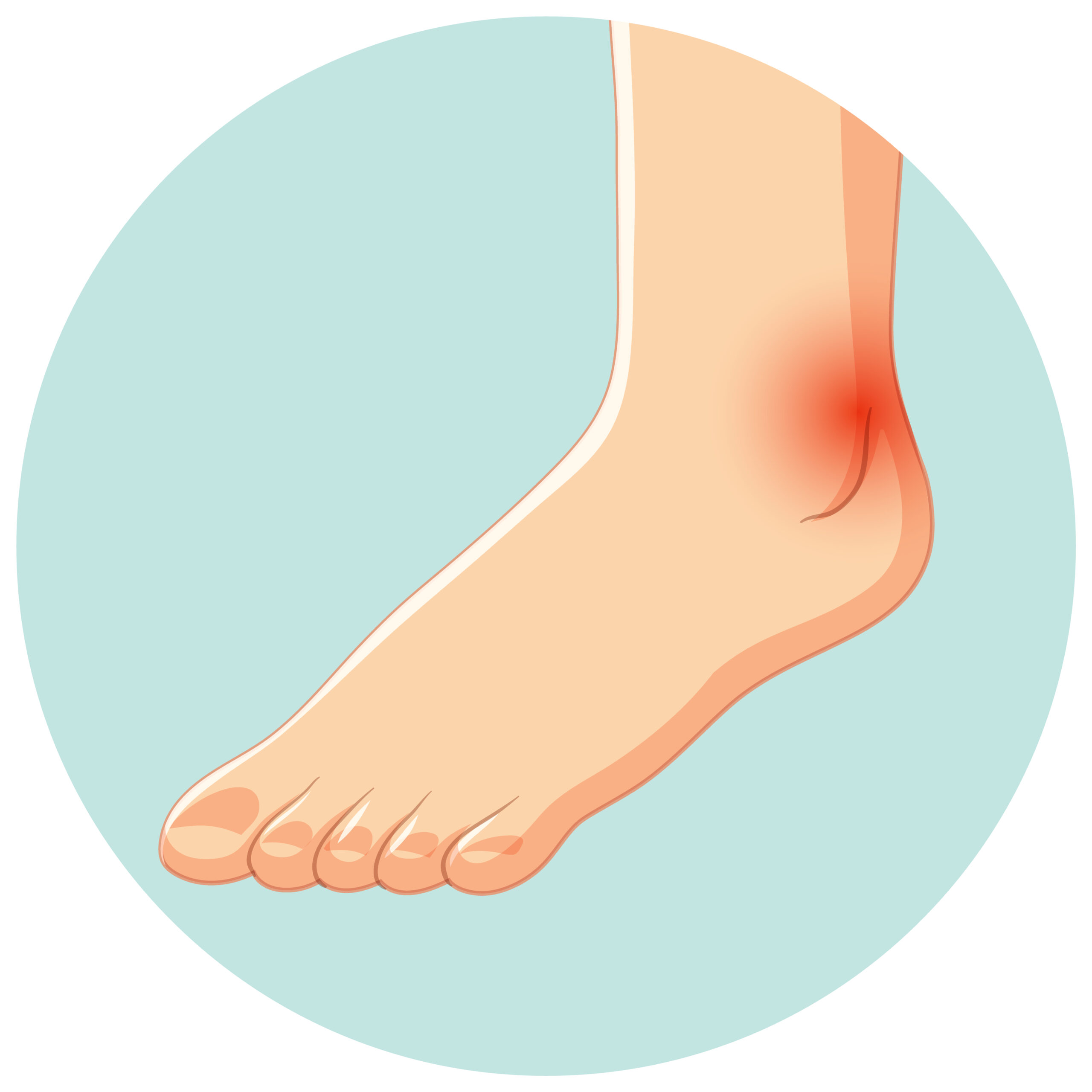 Causes of Foot Pain
