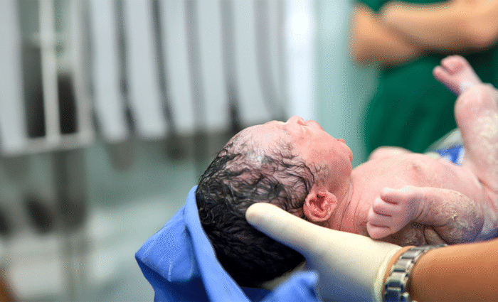 Specialties 7 Arthrogryposis Joint contractures present at birth