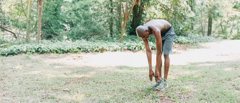 Bow Legs Genu Varum Legs curving outward at the knees