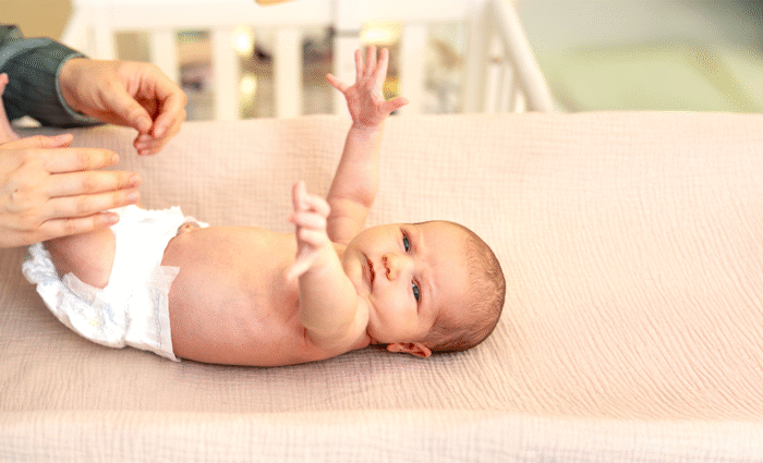 Specialties 4 Congenital Hand Deformities Birth defects affecting hand structure and function