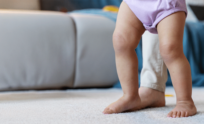 Specialties 6 Congenital Limb Deformities Abnormalities in limb development