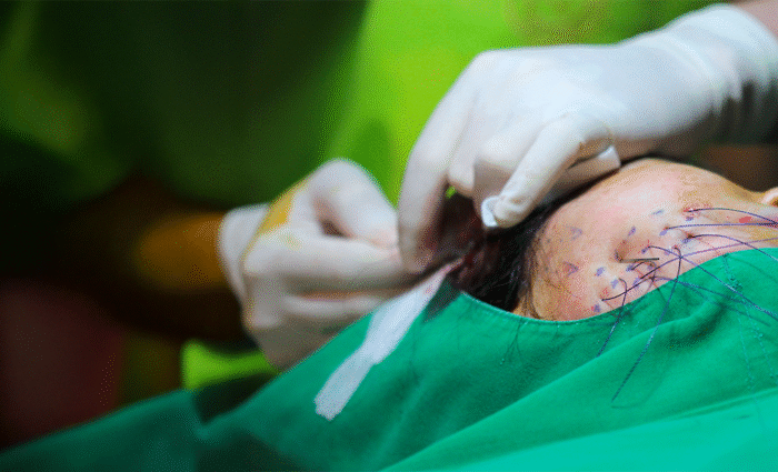 Specialties 9 Degloving Injuries Traumatic removal of skin and underlying tissue requiring complex reconstructive surgery