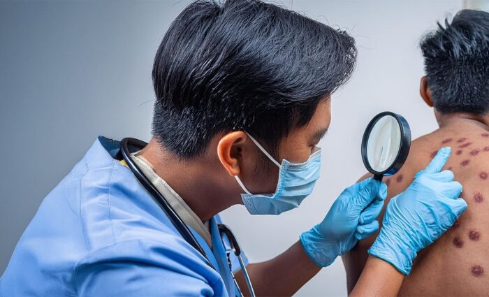 Specialties 7 DermatofibrosarcomaProtuberans Low gradesofttissuesarcomawithhighlocalrecurrenceraterequiringwidesurgicalexcisionwithclearmargin