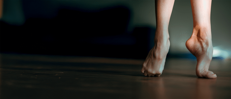 High Arches Pes Cavus Excessively high foot arches