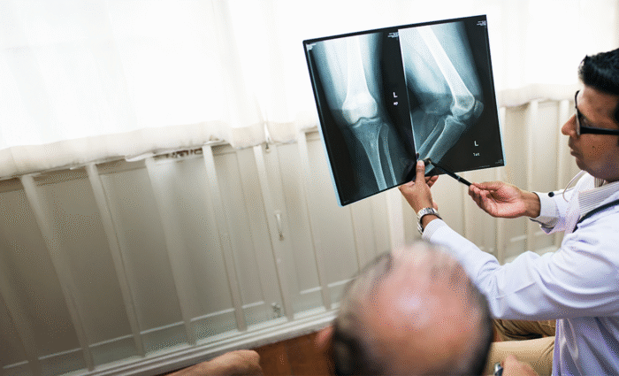 Specialties 9 Radiation Induced Bone Changes Long term bone complications from radiation therapy including fractures and secondary malignancies