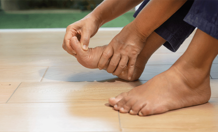 Specialties 7 Flat Feet Pes Planus Collapsed arches leading to the entire foot touching the ground