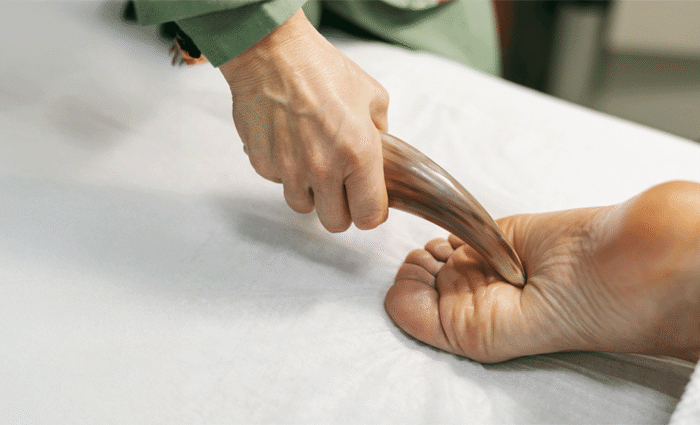 Specialties 10 Morton s Neuroma Thickening of tissue around a nerve between the toes