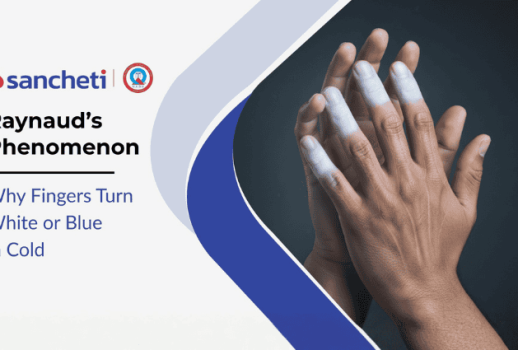 Raynaud's Phenomenon