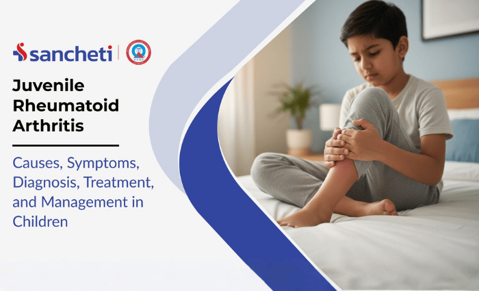 Juvenile Rheumatoid Arthritis: Causes, Symptoms, Diagnosis, and Treatment 1 Juvenile Rheumatoid Arthritis