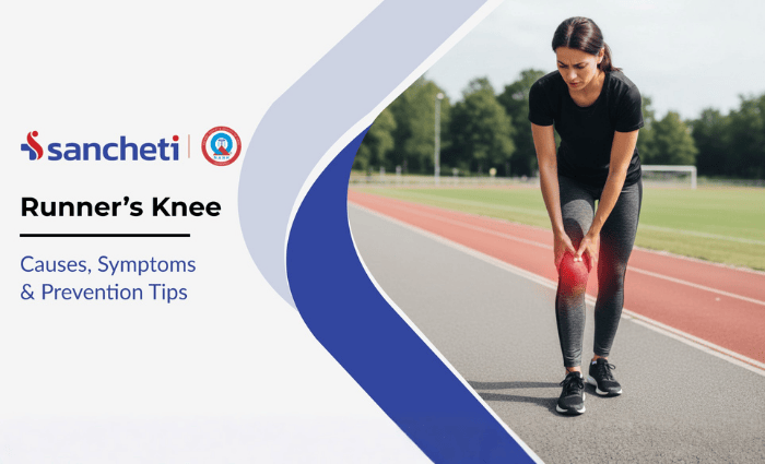 Runner’s Knee: Causes, Symptoms & Prevention Tips 7 Runner's Knee causes, symptoms and treatment