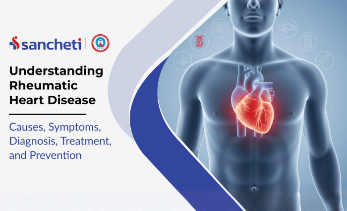 Understanding Rheumatic Heart Disease: Causes, Symptoms, Diagnosis, and Treatment 2 Rheumatic Heart Disease causes, diagnosis, treatment and prevention