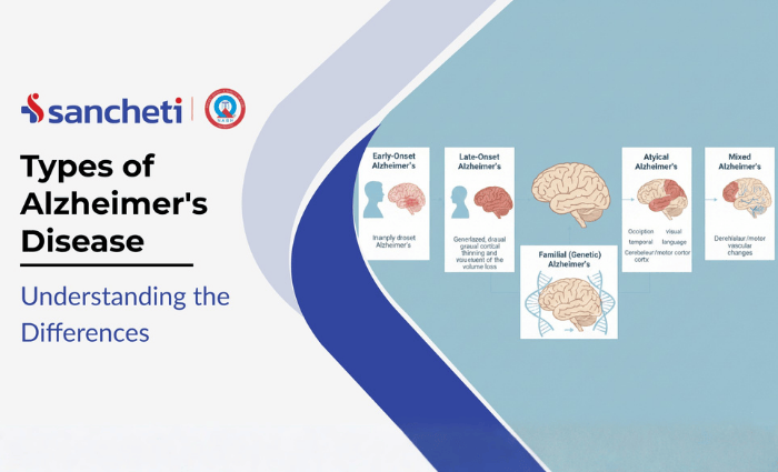 Types of Alzheimer's Disease: Understanding the Differences 8 Types of Alzheimer Disease