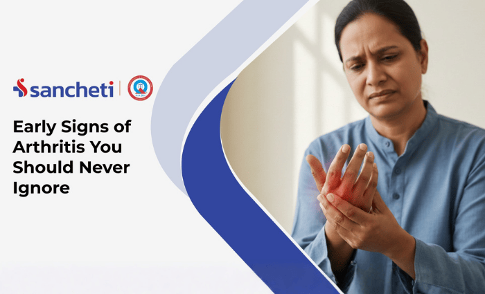 Early Signs of Arthritis You Should Never Ignore 3 Early Signs of Arthritis You Should Never Ignore