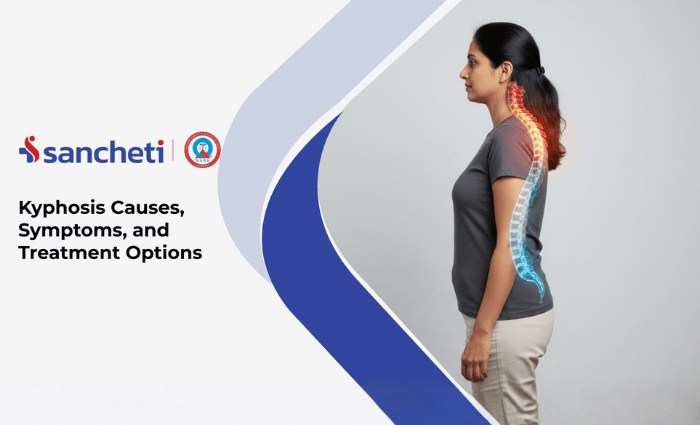 Kyphosis: Causes, Symptoms, and Treatment Options 6 Kyphosis Causes, Symptoms, and Treatment Options