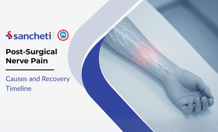 Post-Surgical Nerve Pain: Causes and Recovery Timeline 2 Post-Surgical Nerve Pain Causes and Recovery Timeline