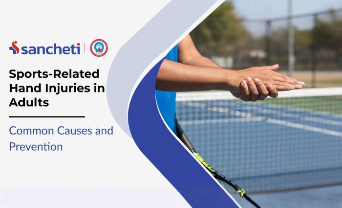 Sports-Related Hand Injuries in Adults: Common Causes and Prevention 6 Sports-Related Hand Injuries in Adults Common Causes and Prevention