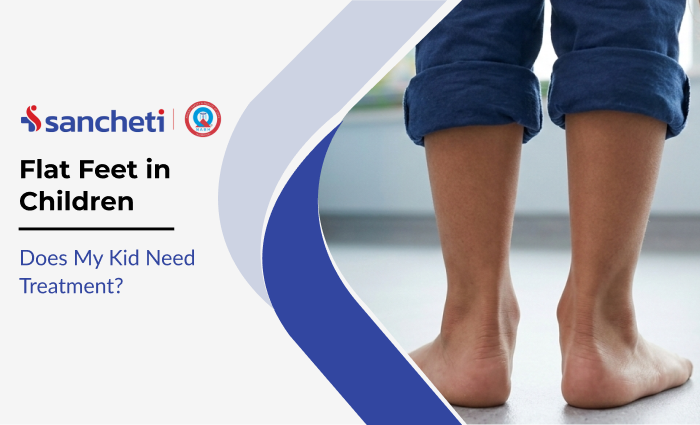 Flat Feet in Children: Does My Kid Need Treatment? 8 Flat Feet in Children Does My Kid Need Treatment