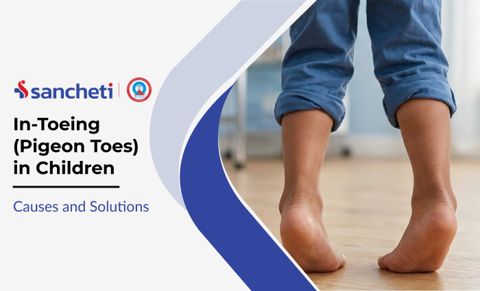 In-Toeing (Pigeon Toes) in Children: Causes and Solutions 7 In-Toeing (Pigeon Toes) in Children_ Causes and Solutions