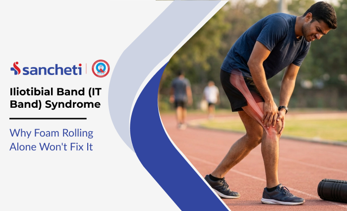 Iliotibial Band (IT Band) Syndrome: Why Foam Rolling Alone Won't Fix It 5 Iliotibial Band (IT Band) Syndrome