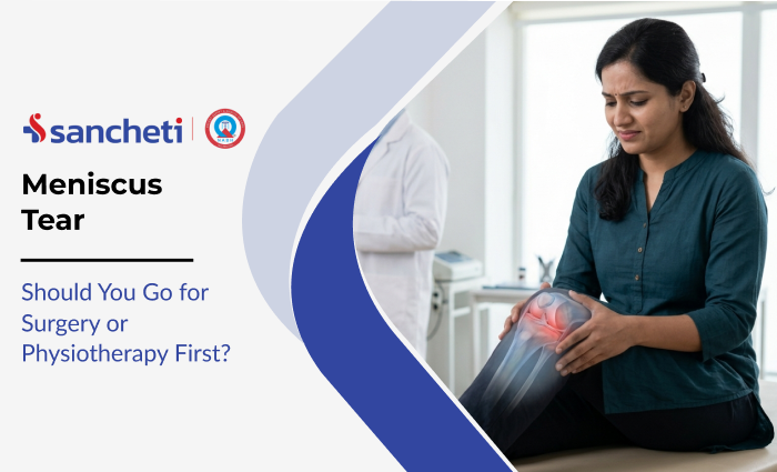 Meniscus Tear: Should You Go for Surgery or Physiotherapy First? 2 Meniscus Tear