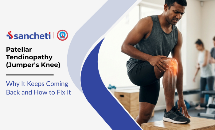 Patellar Tendinopathy (Jumper's Knee): Why It Keeps Coming Back and How to Fix It 9 Patellar Tendinopathy (Jumper's Knee)
