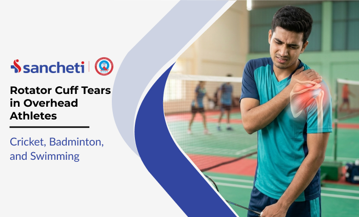 Rotator Cuff Tears in Overhead Athletes: Cricket, Badminton, and Swimming 1 Rotator Cuff Tears in Overhead Athletes