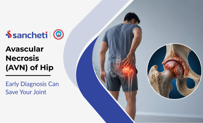 avascular_necrosis_avn_of_hip_early_diagnosis_can_save_your_joint