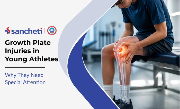 Growth Plate Injuries in Young Athletes: Why They Need Special Attention 2 growth_plate_injuries_in_young_athletes_why_they_need_special_attention
