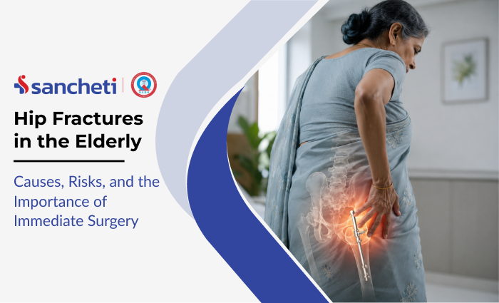 Hip Fractures in the Elderly: Causes, Risks, and the Importance of Immediate Surgery 2 hip_fractures_in_the_elderly_causes_risks_and_the_importance_of_immediate_surgery
