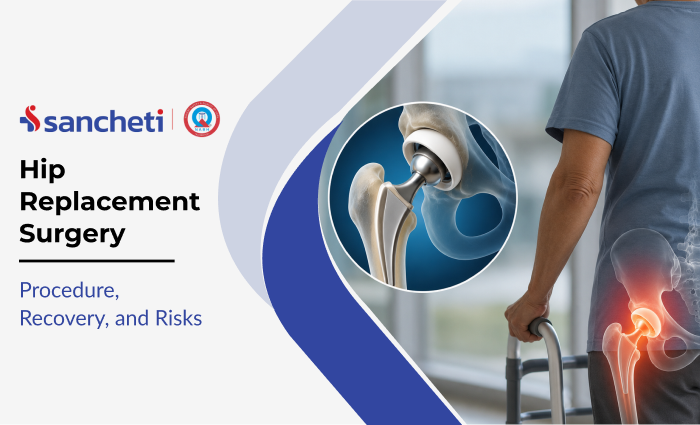 Hip Replacement Surgery: Procedure, Recovery, and Risks 1 hip_replacement_surgery_procedure_recovery_and_risks