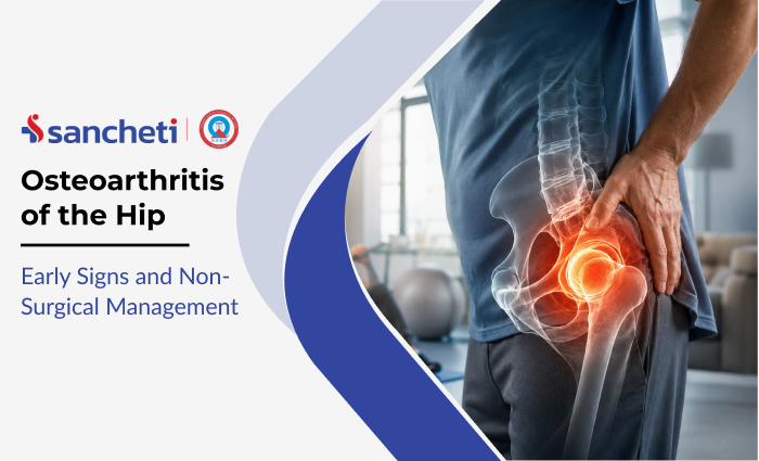 osteoarthritis_of_the_hip_early_signs_and_non_surgical_management