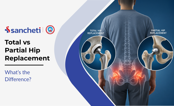 Total vs Partial Hip Replacement: What’s the Difference? 3 total_vs_partial_hip_replacement_what_s_the_difference_