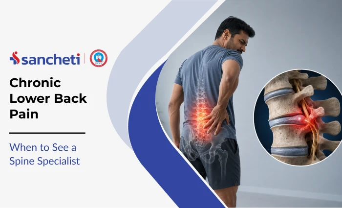 Chronic Lower Back Pain: When to See a Spine Specialist 7 chronic_lower_back_pain_1x
