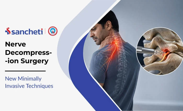 Nerve Decompression Surgery: New Minimally Invasive Techniques 4 nerve_decompress_ion_surgery_1x