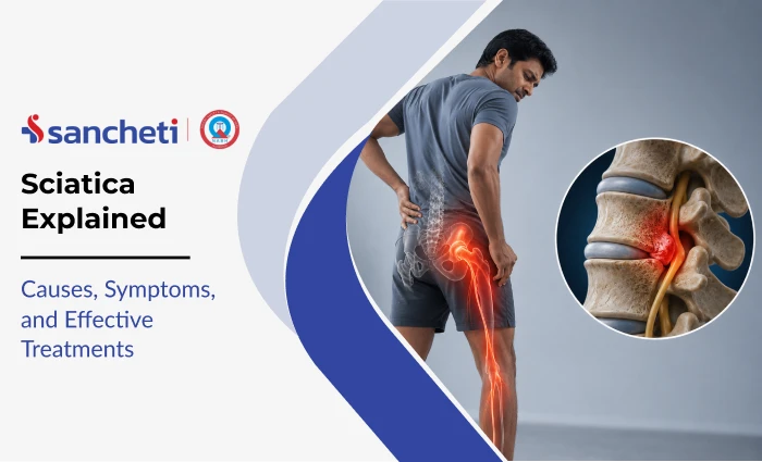 Sciatica Explained: Causes, Symptoms, and Effective Treatments 5 sciatica_explained_1x (1)