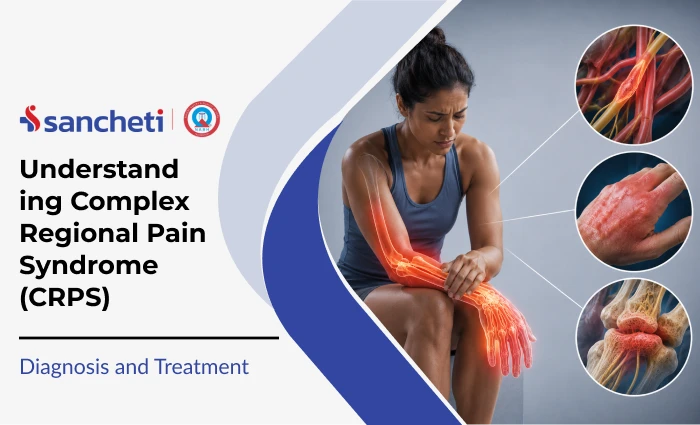 Understanding Complex Regional Pain Syndrome (CRPS): Diagnosis and Treatment 1 understanding_complex_regional_pain_syndrome_crps__1x (1)