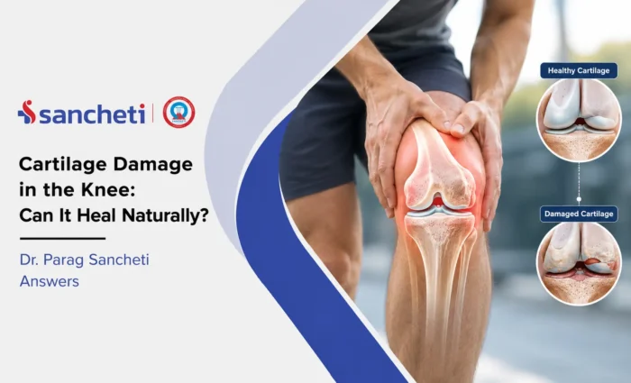 Cartilage Damage in the Knee Can It Heal Naturally Dr. Parag Sancheti Answers