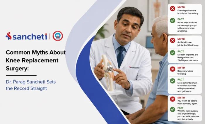 Common Myths About Knee Replacement Surgery Dr. Parag Sancheti Sets the Record Straight