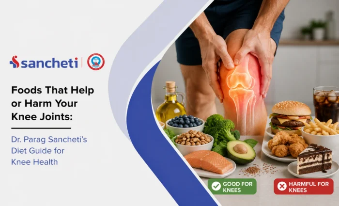 Foods That Help or Harm Your Knee Joints Dr. Parag Sancheti's Diet Guide for Knee Health